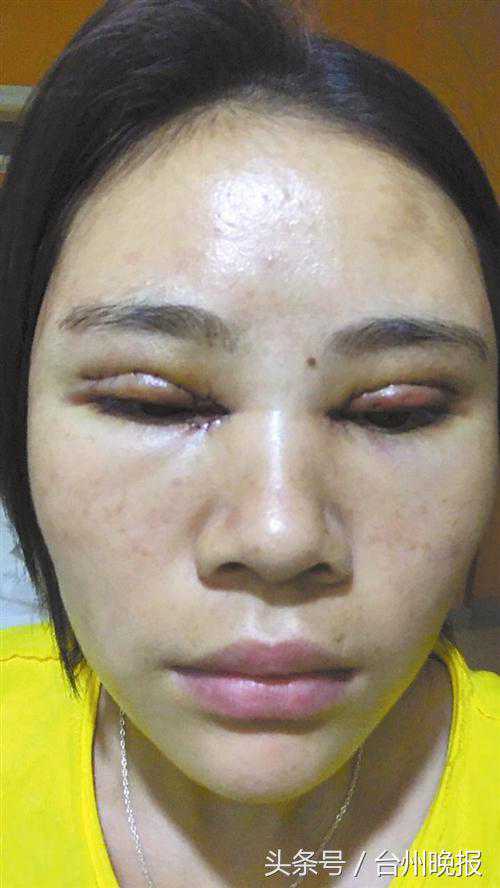 爱美的小高到路桥博士医疗美容做眼睛整形，花费1万多元却……