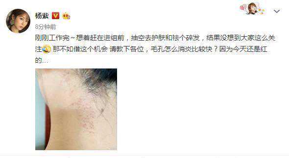 杨紫现身整形美容医院被嘲，牙齿矫形算不算整形？