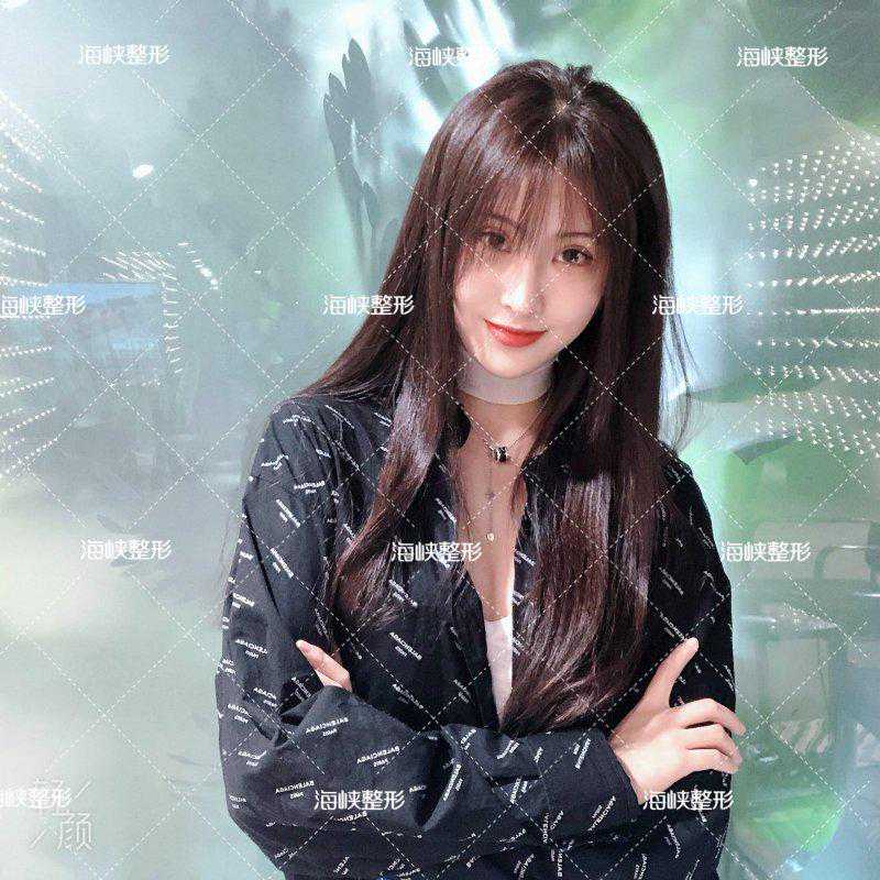 济南海峡整形分享：祛痘你找对方法了吗？