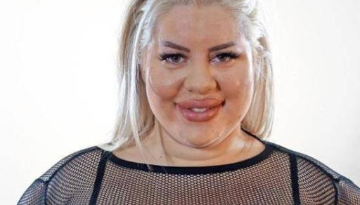 瑞24岁女子整形上瘾，做了5次丰臀手术，臀围达到了190cm