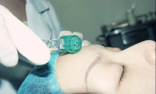 微针美容靠不靠谱？会不会有副作用？