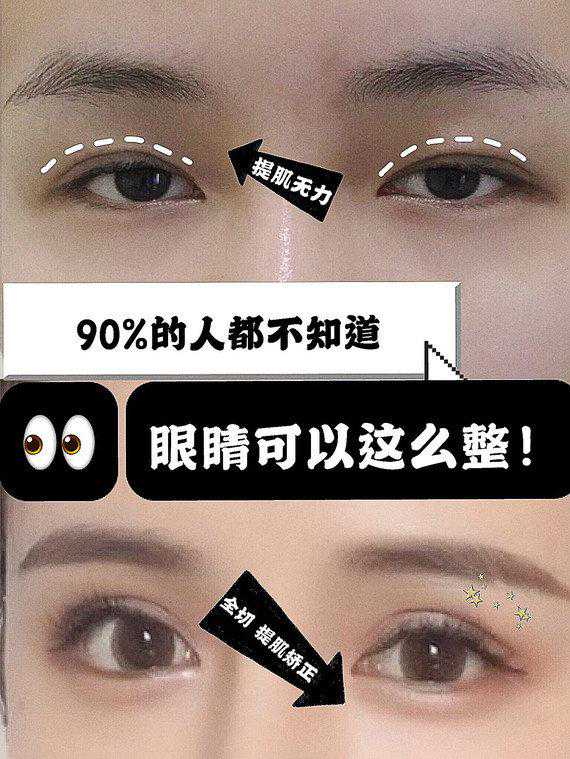 关医生整形功课：眼部问题最强攻略来啦！眼睛这么整，颜值up