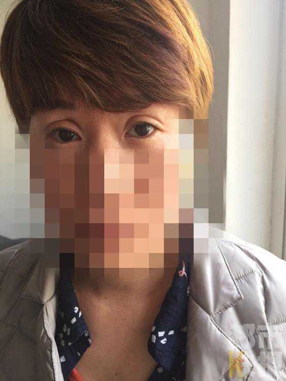 西安女子“黑美容”割双眼皮 吓哭小孩