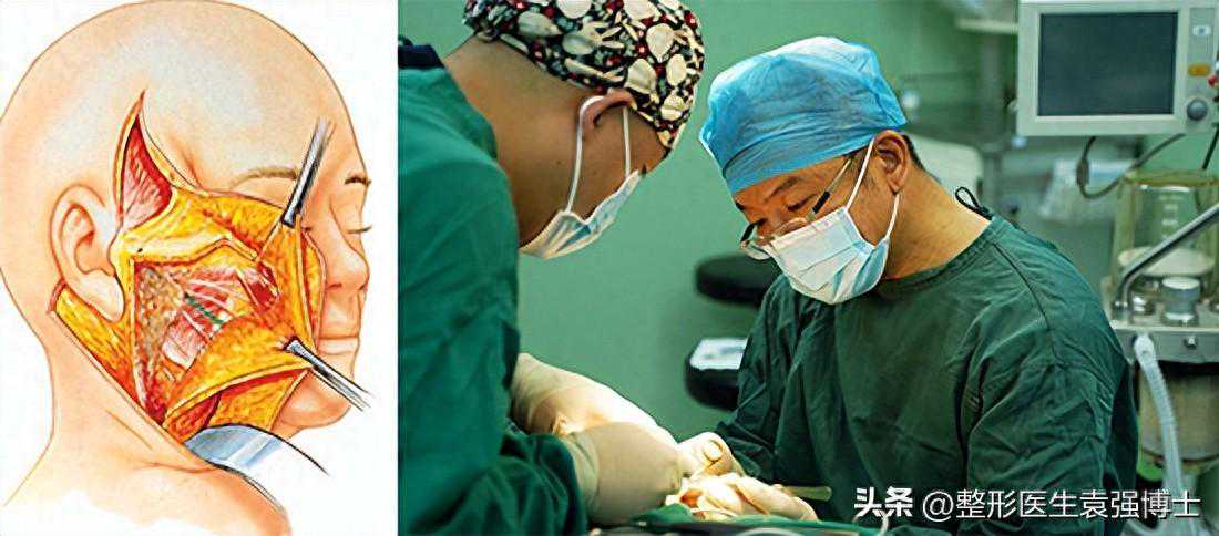 整形医生揭秘：拉皮手术，为什么被称为皮肤紧致的终极武器！