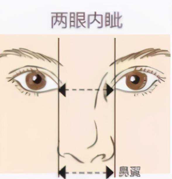 长沙美之峰丁翔：关于亚洲人整形中常见的鼻部问题，你知道多少？