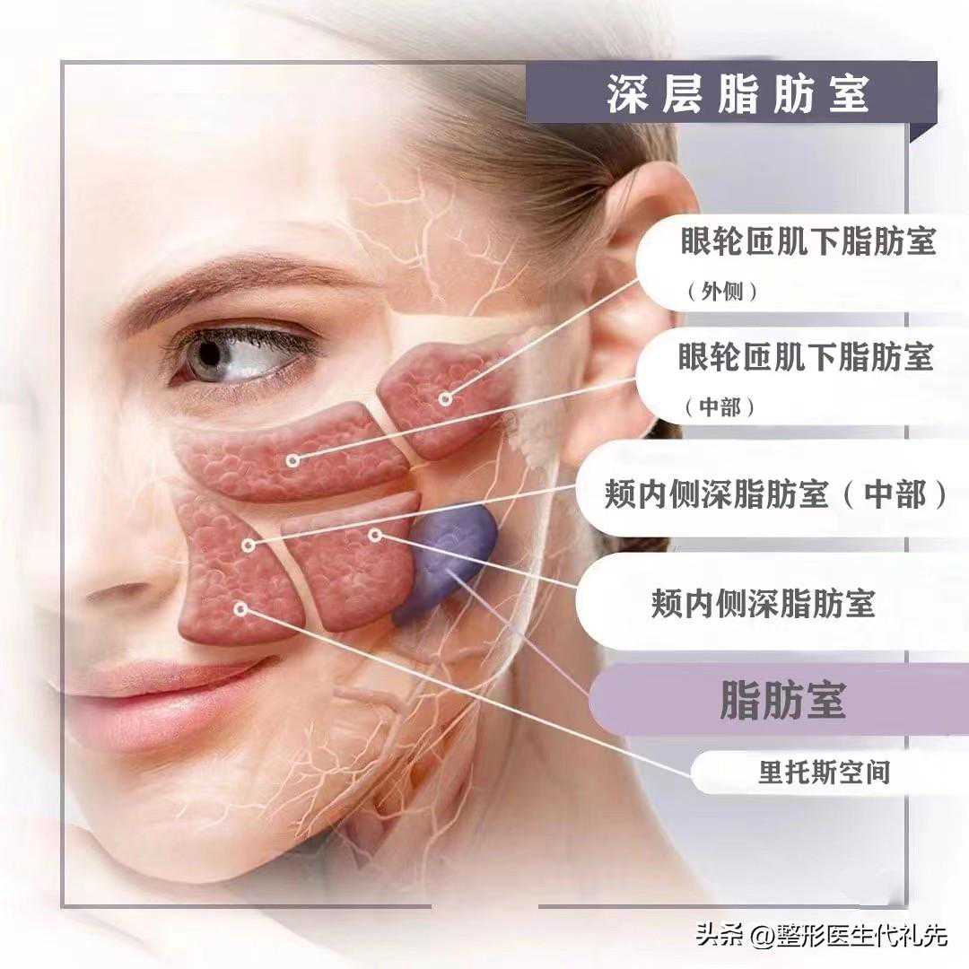 关于眼周、面部脂肪加减术后需要注意的五个问题（整形医生总结）