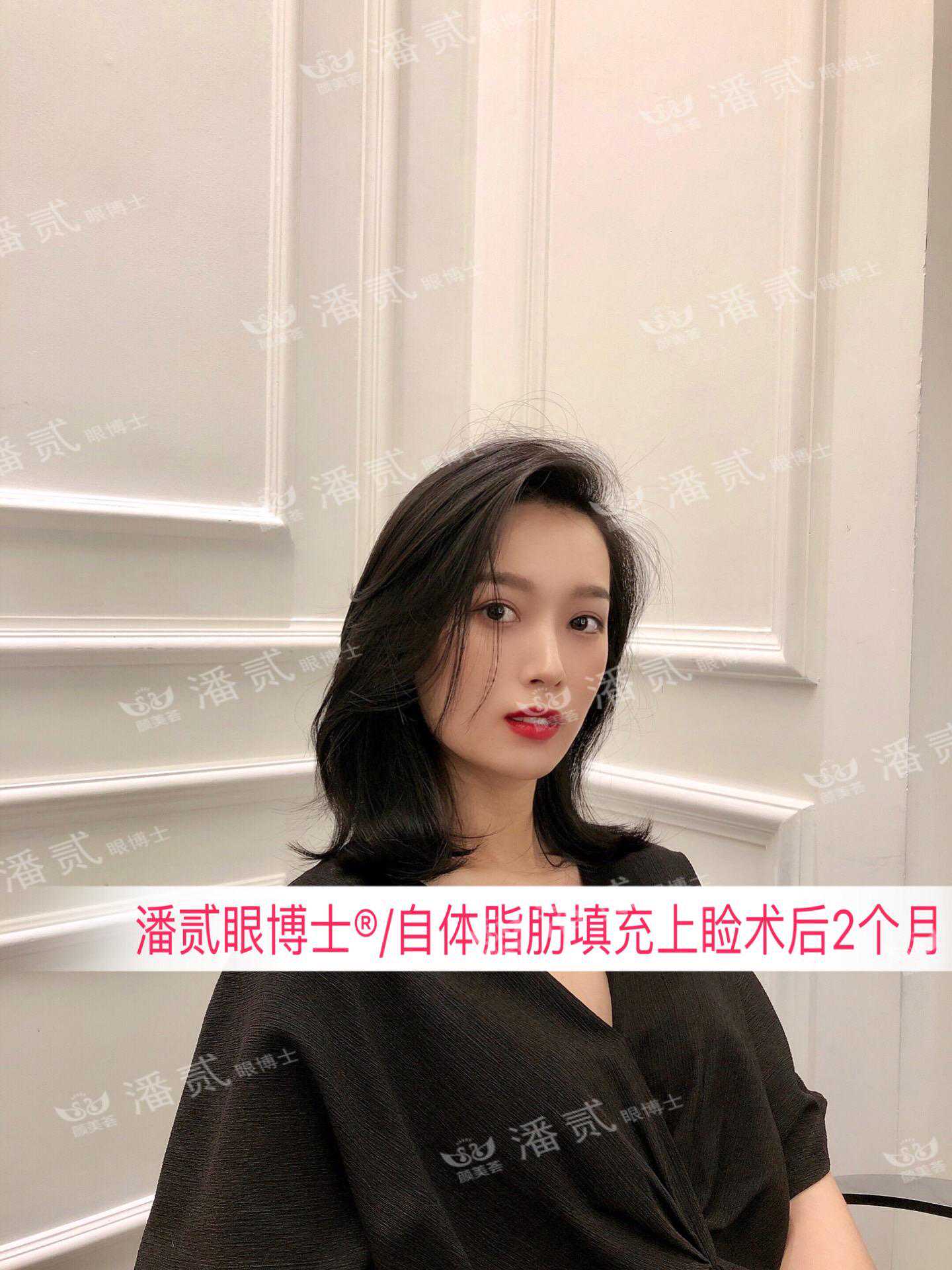 深圳模特因眼整形失败遭遇人生变故，从此不敢上镜、顿失工作收入