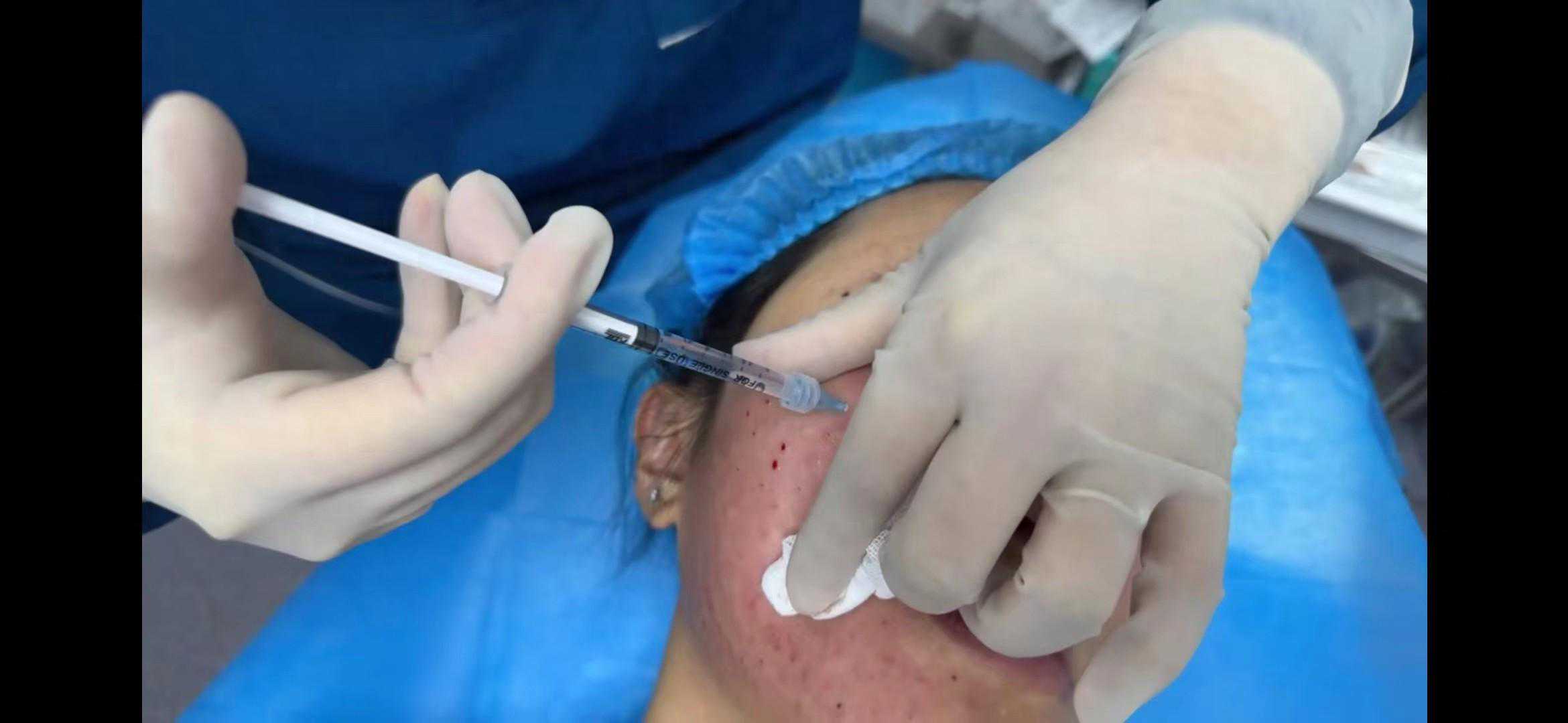 暗访“擦边”的美容针：藏身美甲店，买四千元产品包教打针