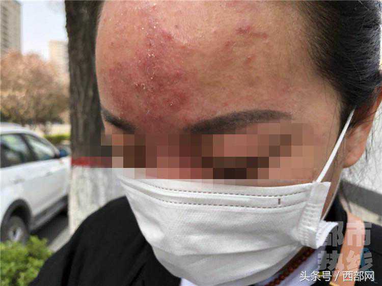 女子为在儿子婚礼惊艳亮相，花三万九美容却毁容，痛哭：我像个鬼