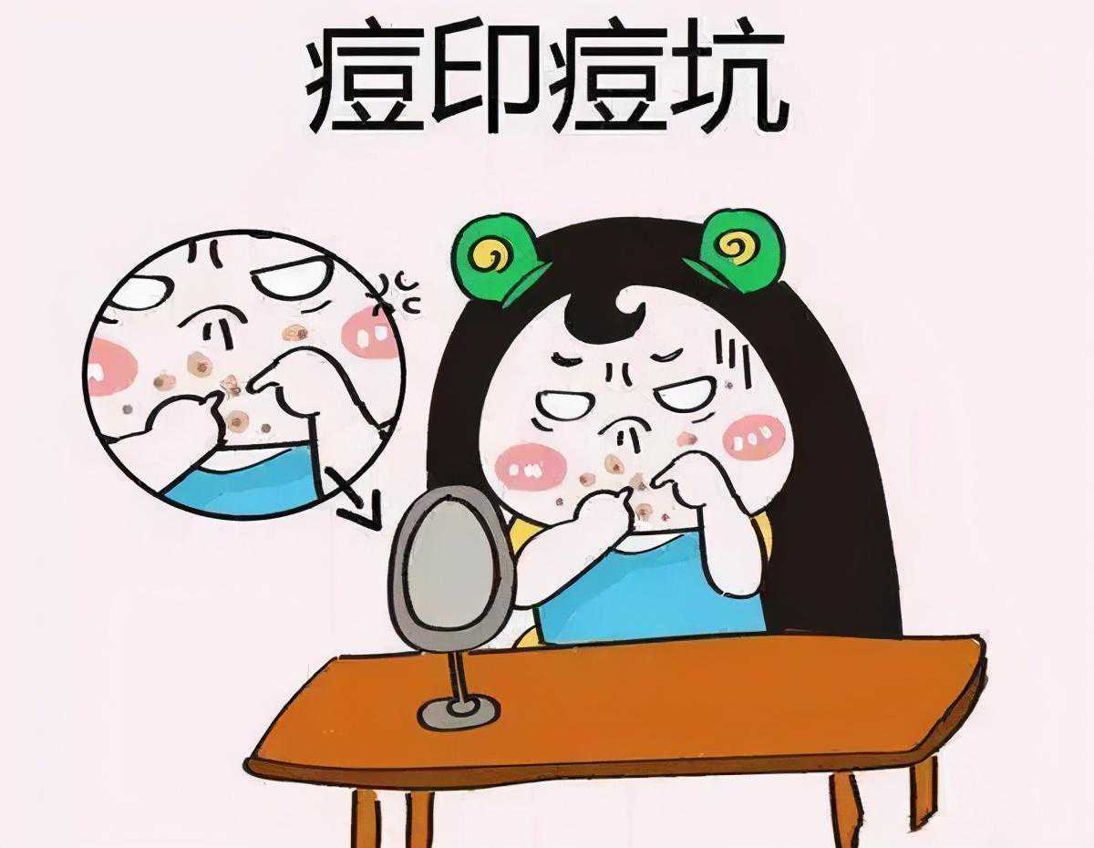 【医学美容】“战痘”胜利的你，应该怎样打扫“痘印”这个战场—光子治疗助您快速祛除痘印