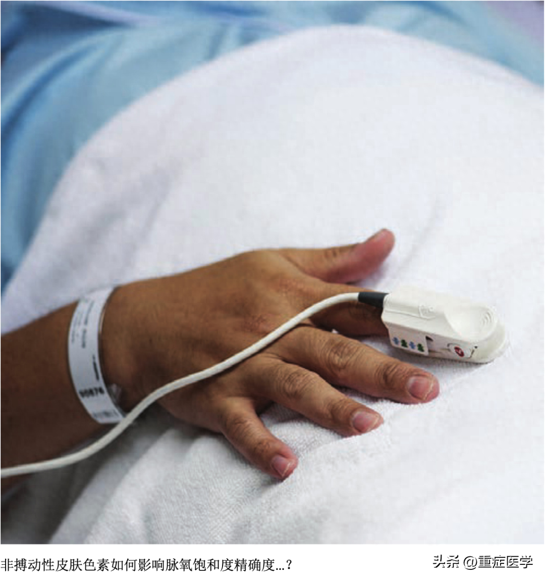 脉氧仪是惊艳的，但并不完美