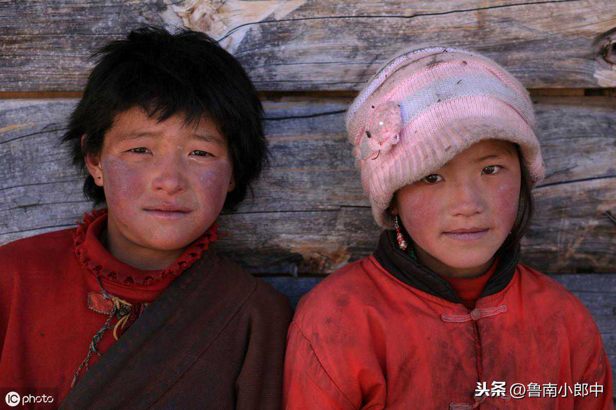 脸上总是泛红，有时还干燥过敏痒？看看是不是这个疾病