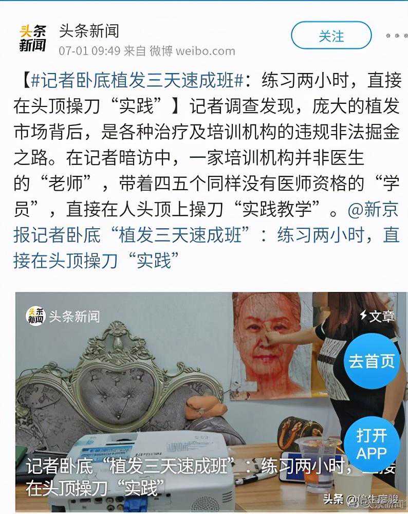 广州植发价格冰点是多少