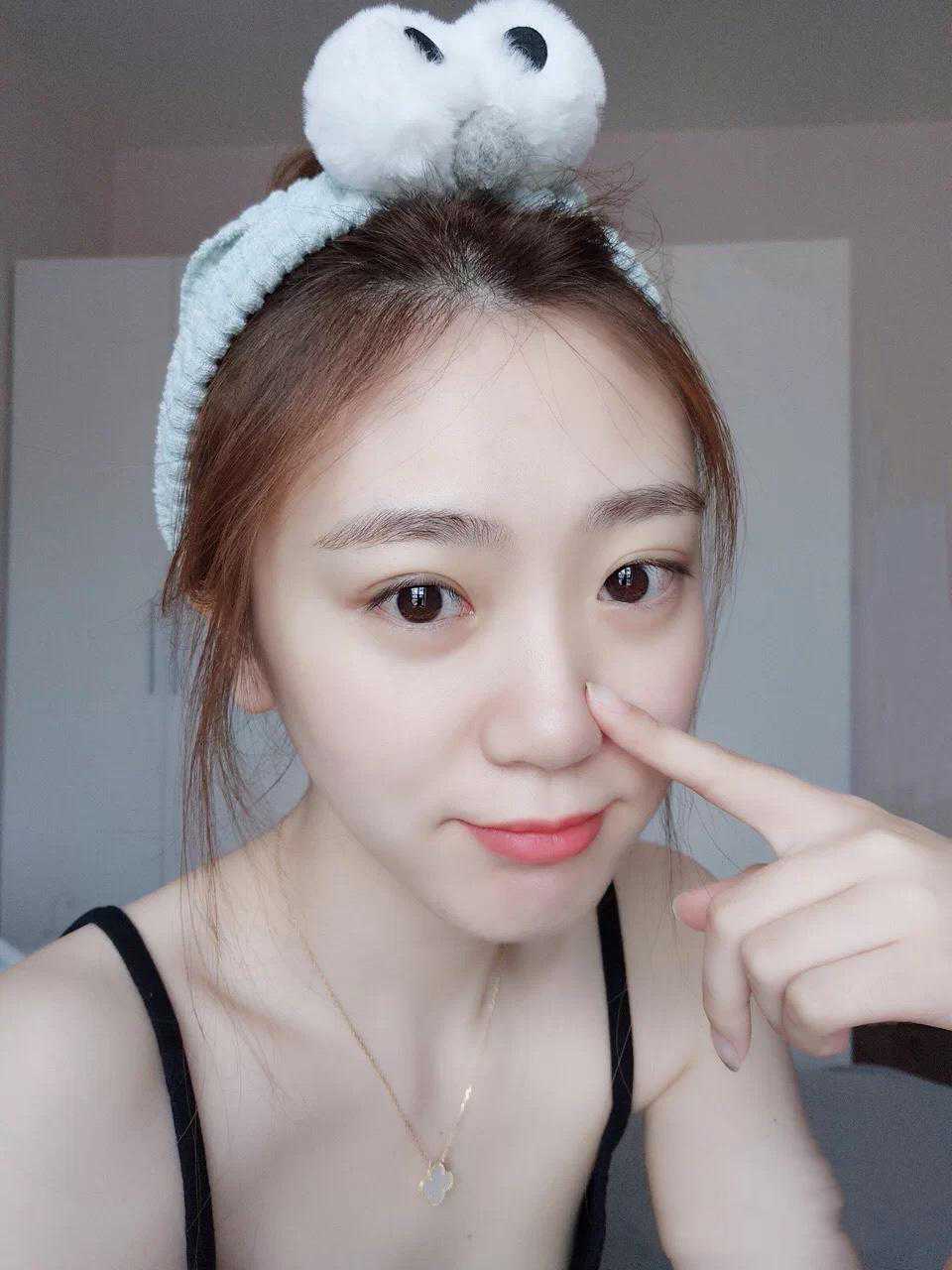 去黑头粉刺闭口最有效的方法有哪些？这些小方法，或许可以帮到你