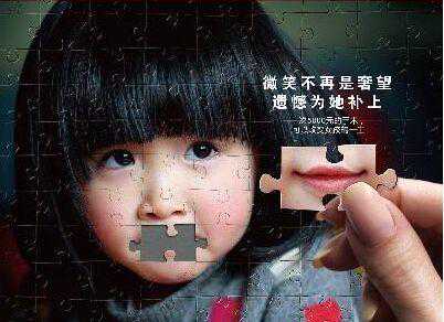 “兔唇”修复那些事儿！