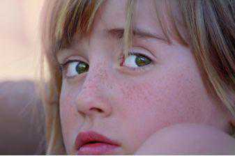 日常生活中，如何鉴别面部常见色斑和痣？