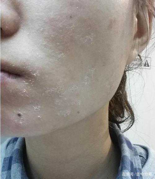 化完妆面部不适应、起皮怎么办？教你几招不脏又干净清爽的方法