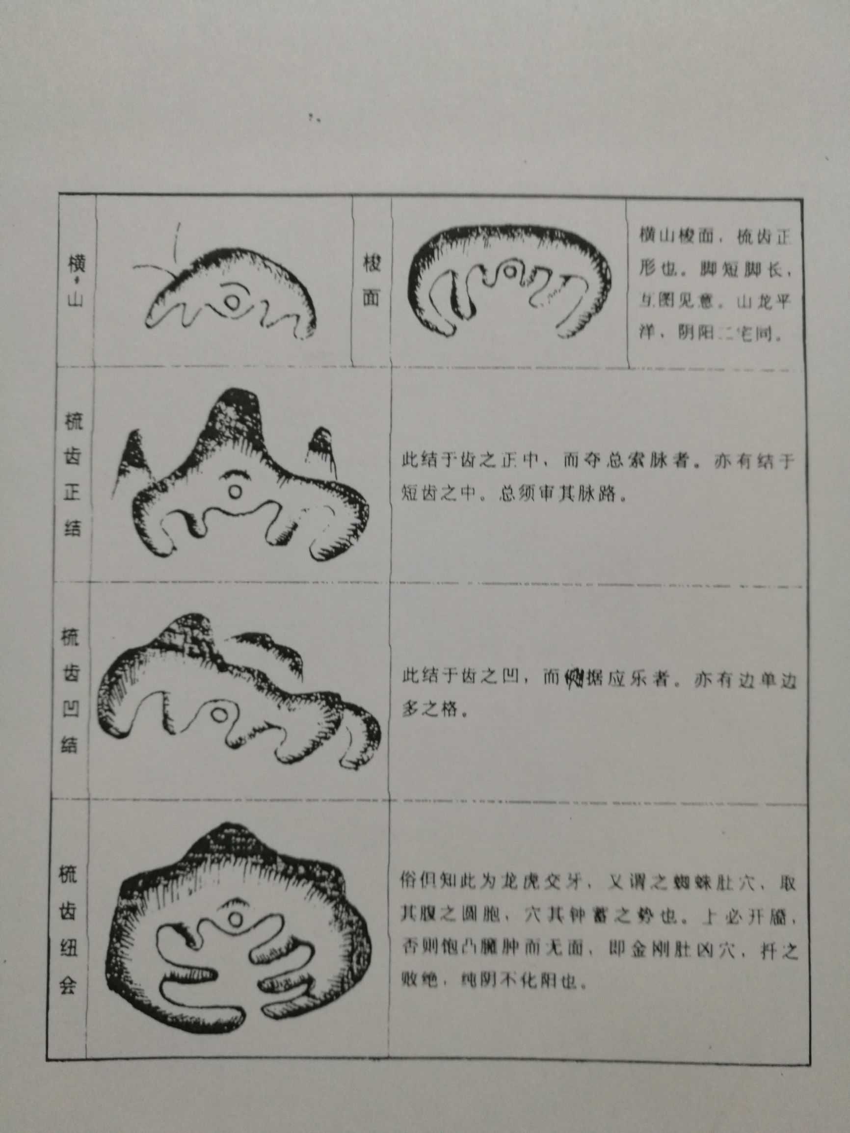 古法点穴何止窝钳乳突四象