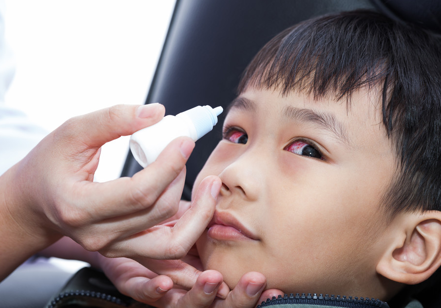 麦粒肿是什么回事？出现这4大症状要提高警惕