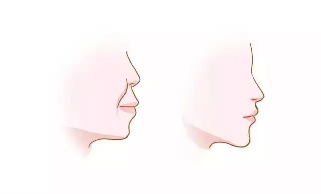 这可能是最全的牙齿矫正攻略，收着肯定有用