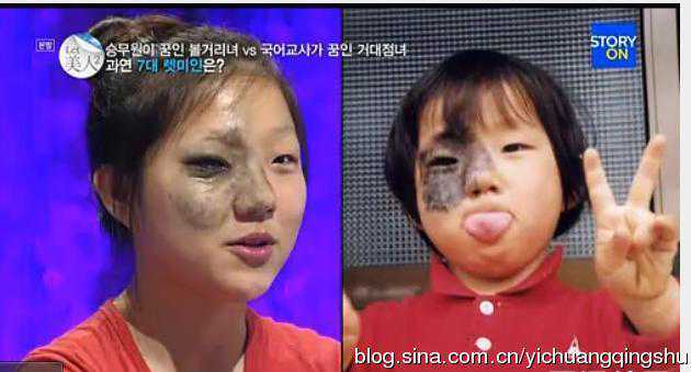 韩国整容节目《Let 美人》整容前后对比