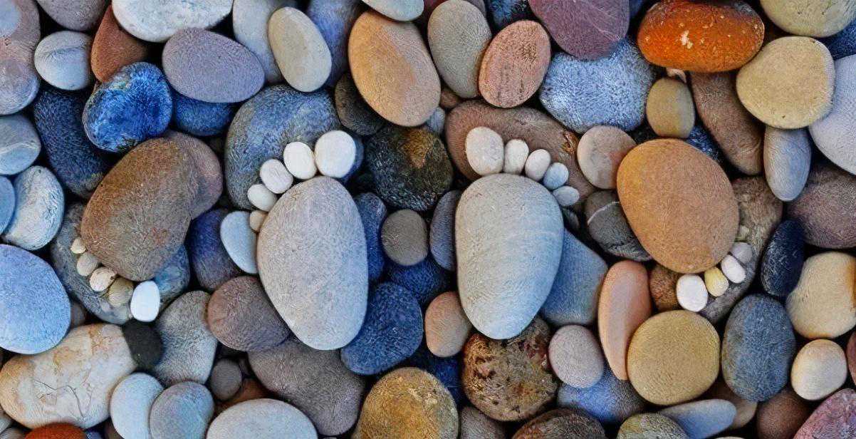 高弓足的危害及治疗方法