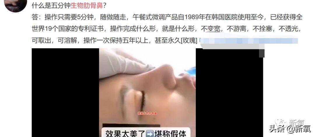 不动刀无假体、一次注射就能保10年的生物骨隆鼻？真是瞎吹