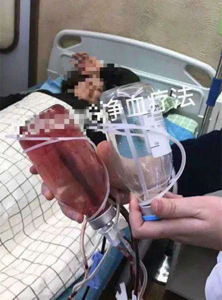 网红带火“净血美容”，5万一次能“防癌”？真相是……