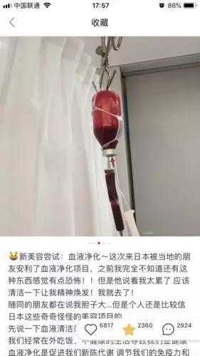 “洗血”可以美容排毒？专家：“血净”有风险，效果被夸大了
